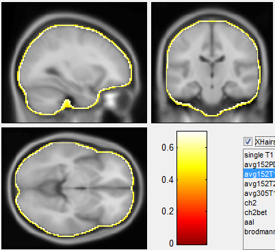 Brain Surface Mask Template (MNI) Brain Surface Mask Template (MNI)