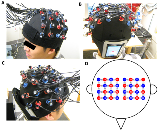 Sensitivity of fNIRS measurement to head motion: An applied use of smartphones in the lab