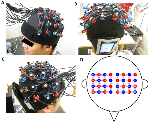 Sensitivity of fNIRS measurement to head motion: An applied use of smartphones in the lab Sensitivity of fNIRS measurement to head motion: An applied use of smartphones in the lab